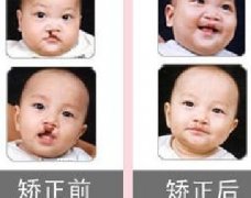 吃兔肉真的會長兔唇？為什么會長兔唇？